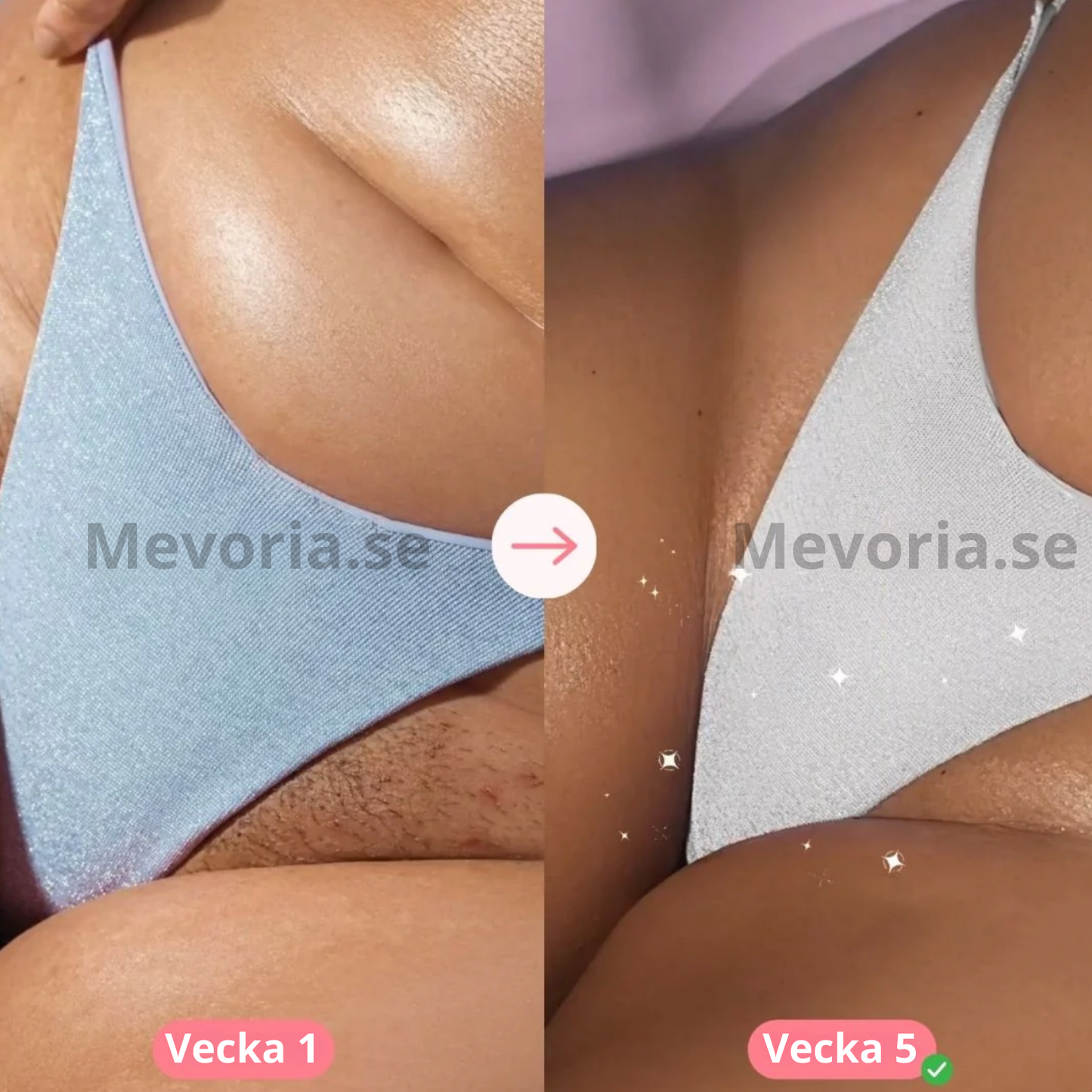 Mevoria IPL Pro® - Permanent Hårborttagare