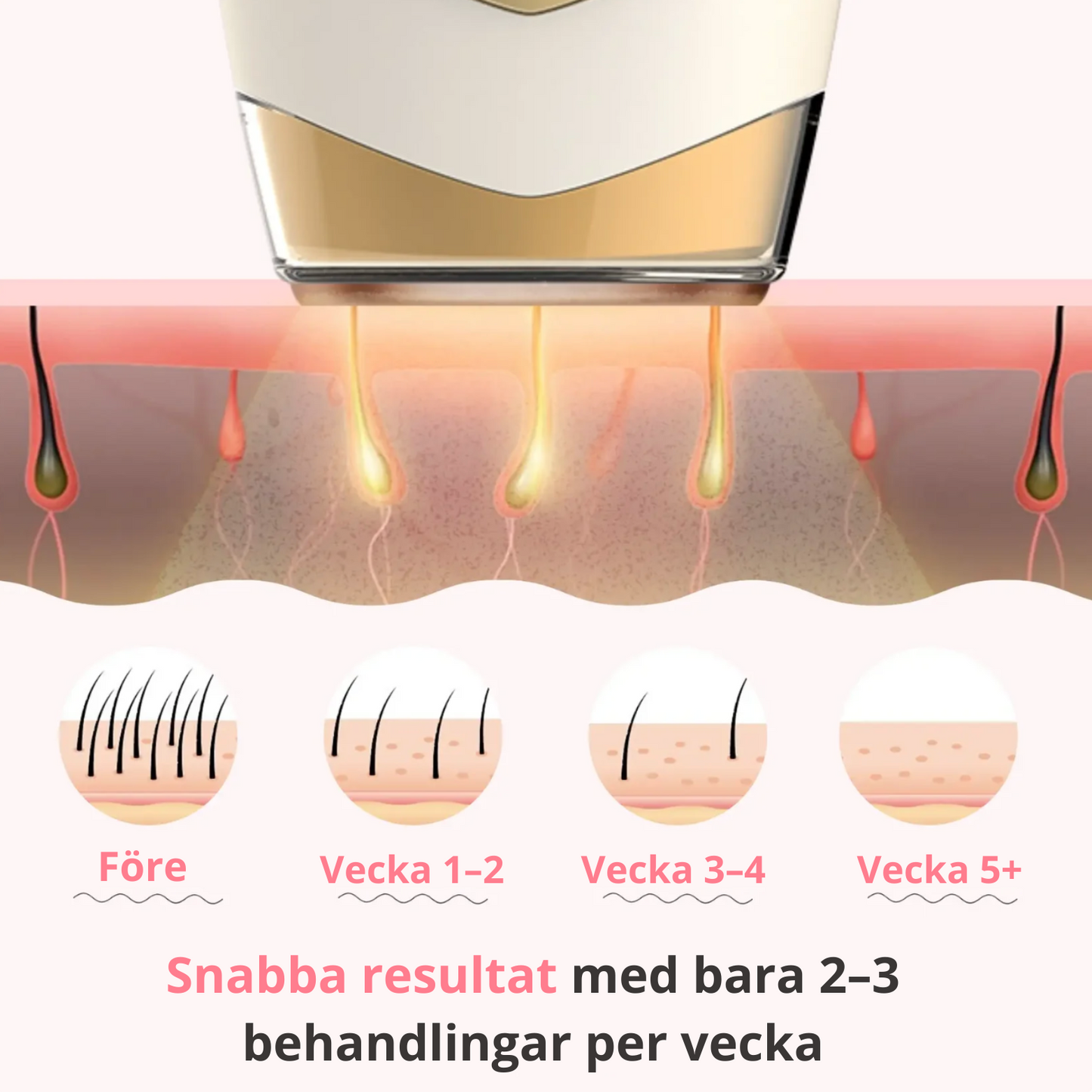 Mevoria IPL Pro® - Permanent Hårborttagare